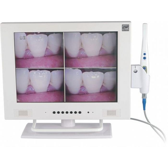 MLG® M-958A 15-Zoll-LCD und 1/4 SONY CCD hohe Auflösende Intraoral kamera