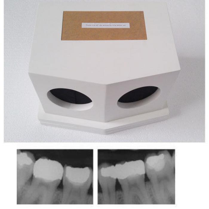 NUER Dentaler Labor Röntgenfilm oraler automatischer Prozessor-Entwickler 220V