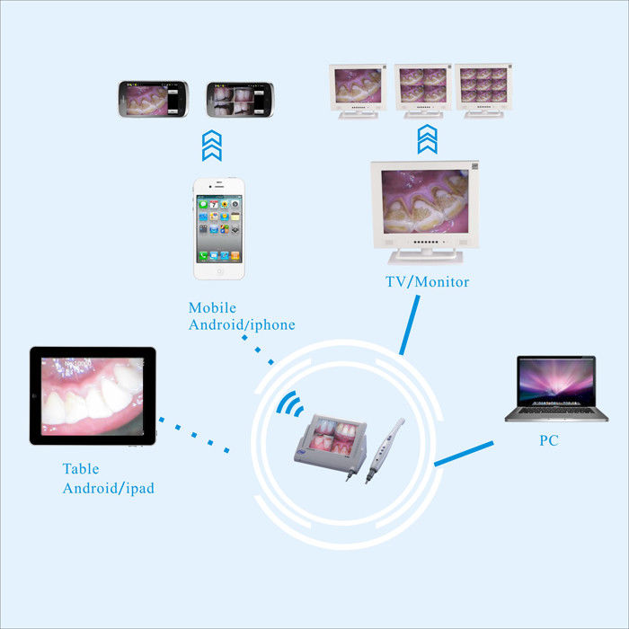 Dental Drahtgebundene WI-FI Intraoralkamera CF-988A mit 8-Zoll-LCD-Minotor M-868