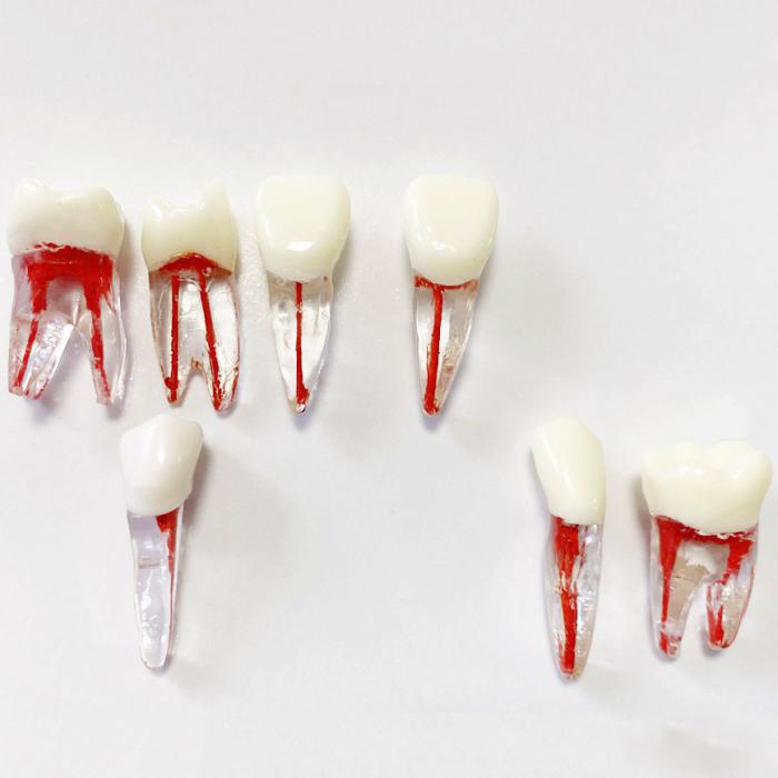 Dental Modellzähne Endo Übungszahn Molarer Oberer Unterer Zahn Prämolarenwurzel 2/3-wurzeliger Kanal