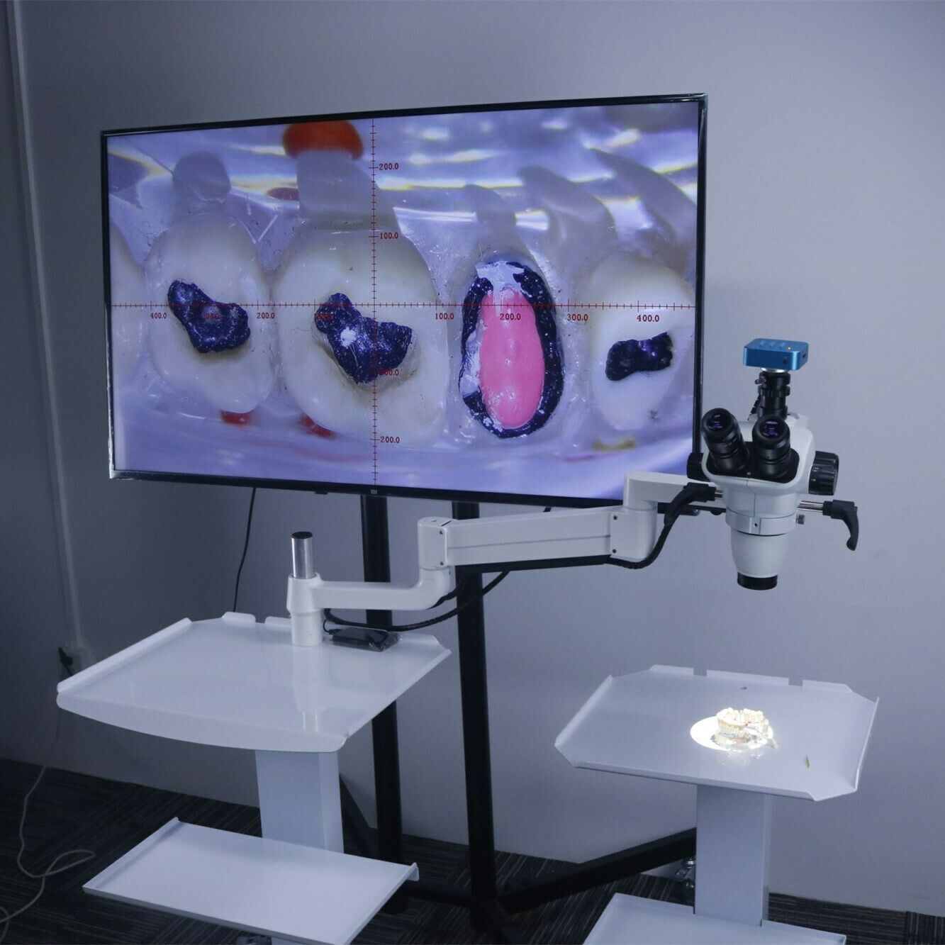Dentalmikroskope für zahnärztliche Wurzelkanaltherapie mit Kamera + Zahnarzt Trolley