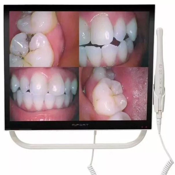 Magenta YFHD-D Dental Intraoralkamera 1/4 Sony CCD mit 17 Zoll Monitor und Halterung