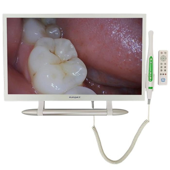 Magenta YF-2200M Dental-Intraoralkamera mit 21,5 Zoll Monitor und WIFI-Übertragungs