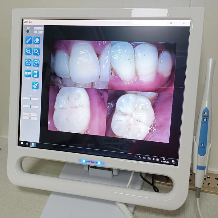 Magenta YF-1700P+ Dental 17 Zoll Touchscreen Intraorale Kamera