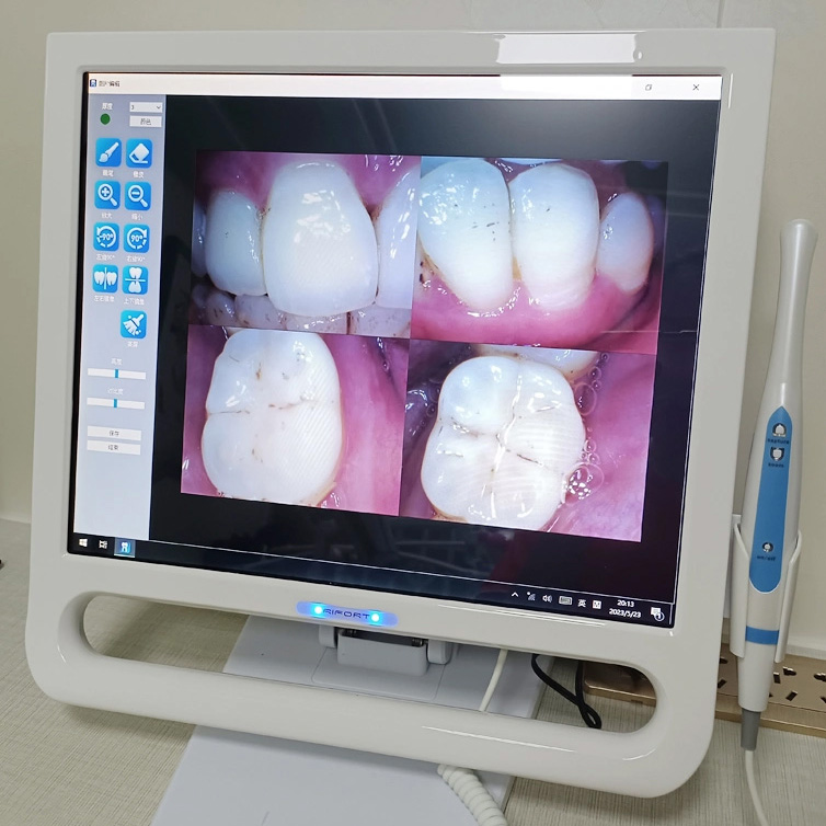 Magenta YF-1700P+ Dental 17 Zoll Touchscreen Intraorale Kamera