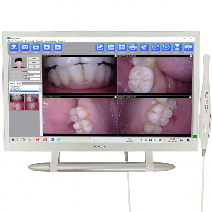 Magenta YF-2200P+ Dental Intraoralkamera VGA+HDMI mit 21,5 Zoll Touchscreen