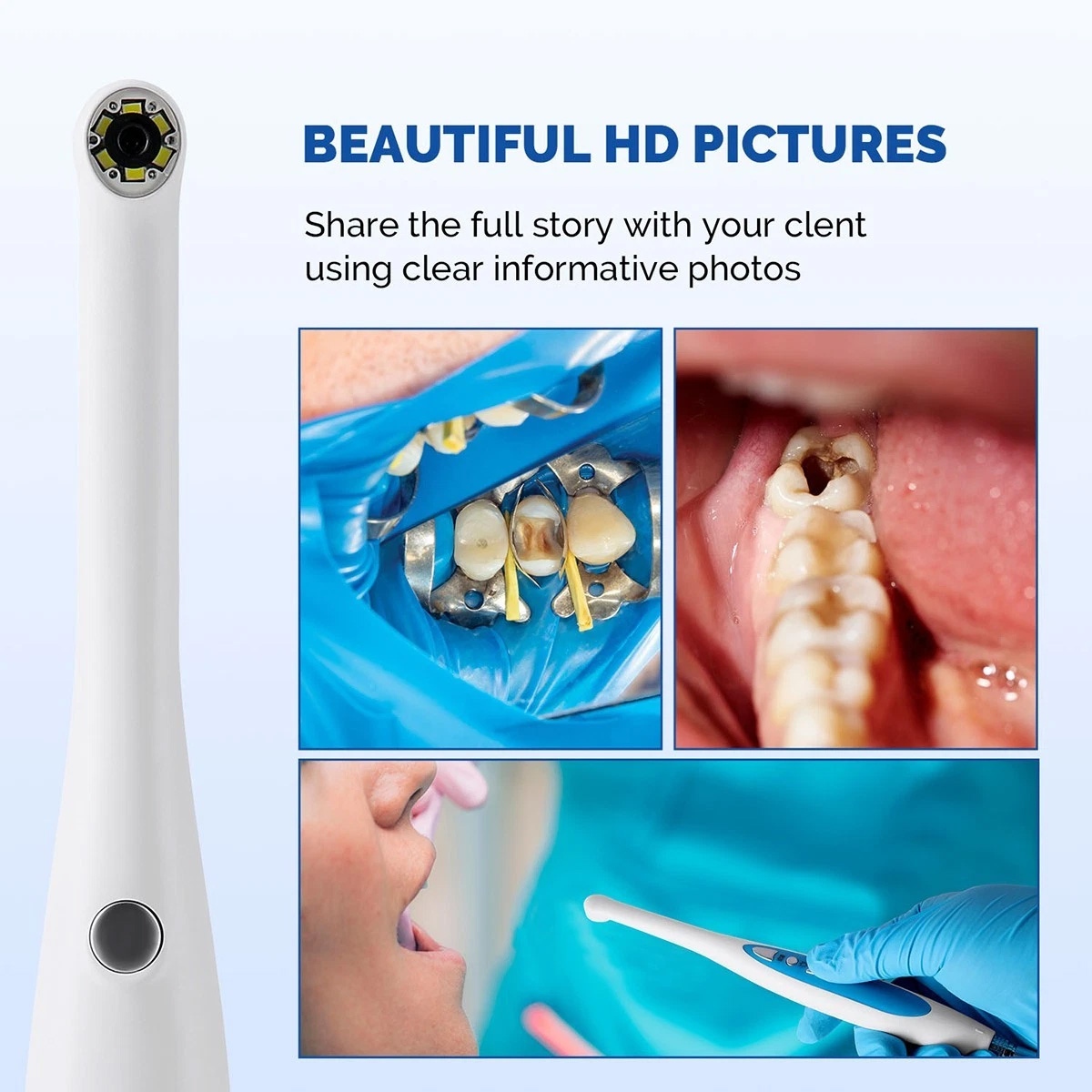 Magenta MD280 720P HD USB Dentale Intraoralkamera für Win 10/11