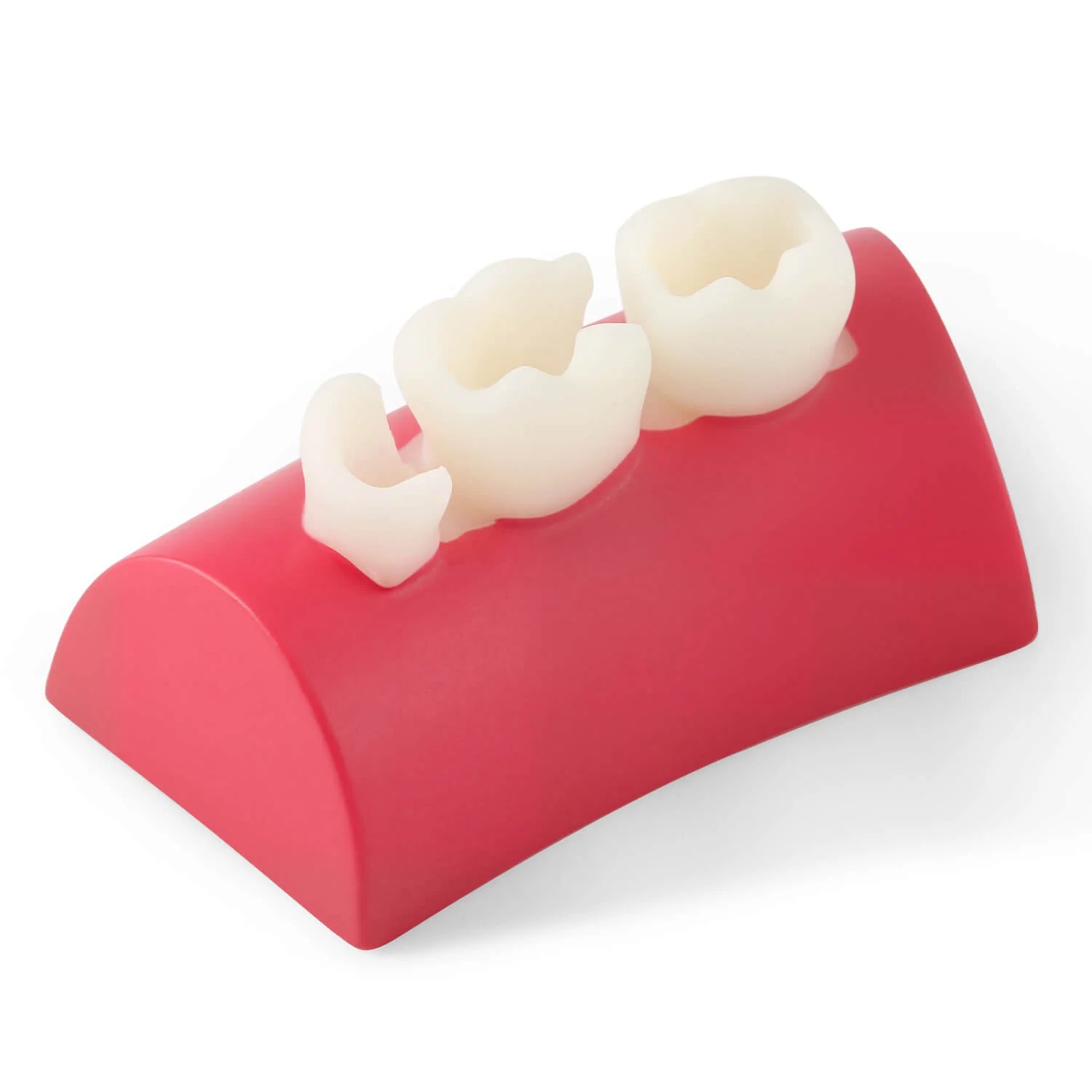 Dental Inlay Übungsblock Komposit-Harz Füllung Zähne