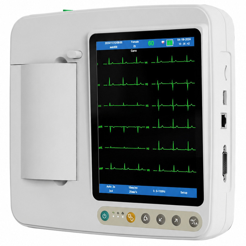 SINNOR ECG 906 12-Kanal Elektrokardiogramm (EKG-Gerät) mit 6-Kanal-Display