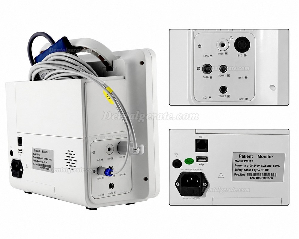 12-Zoll-Multiparameter-Patientenmonitor EKG/Atemwege/Temperatur/NIBP/SpO2/PR 12-Zoll-Multiparameter-Patientenmonitor EKG/Atemwege/Temperatur/NIBP/SpO2/PR