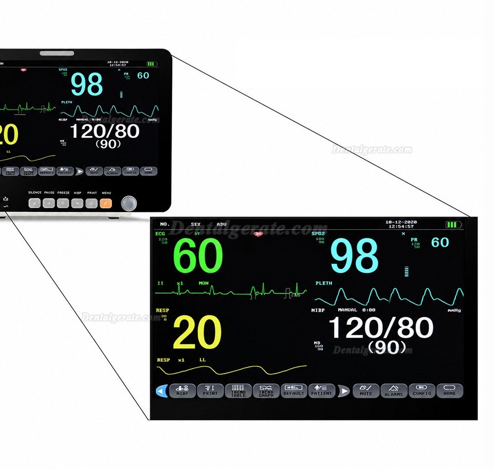 15,6" Multiparameter-Patientenmonitor EKG NIBP Atmung Temperatur SpO2 Pulsfrequenz