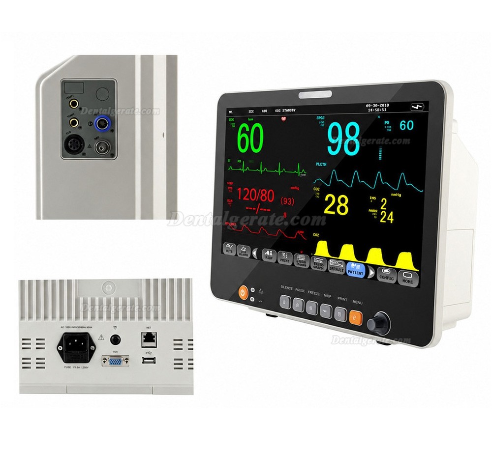 15,6" Multiparameter-Patientenmonitor EKG NIBP Atmung Temperatur SpO2 Pulsfrequenz