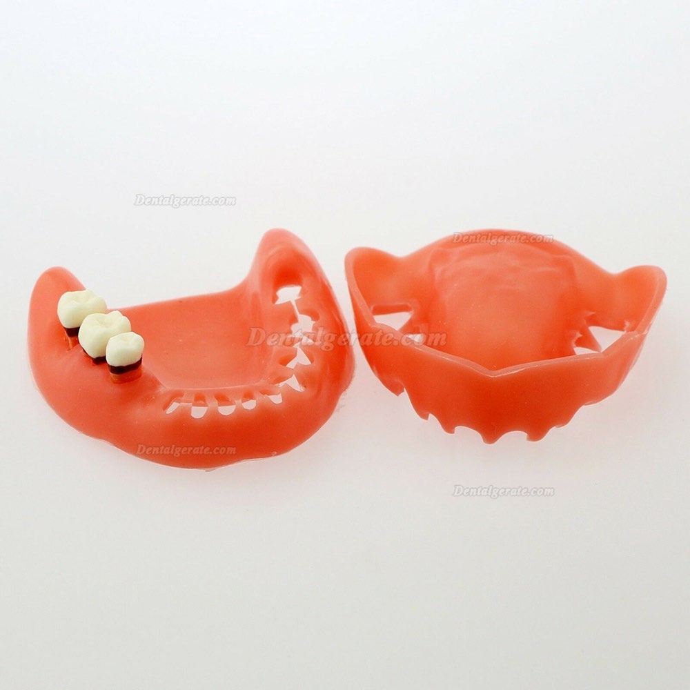 Dentalmodell Erwachsene Pathologische Parodontitis Studienzähne Modell 4017 Dentalmodell Erwachsene Pathologische Parodontitis Studienzähne Modell 4017