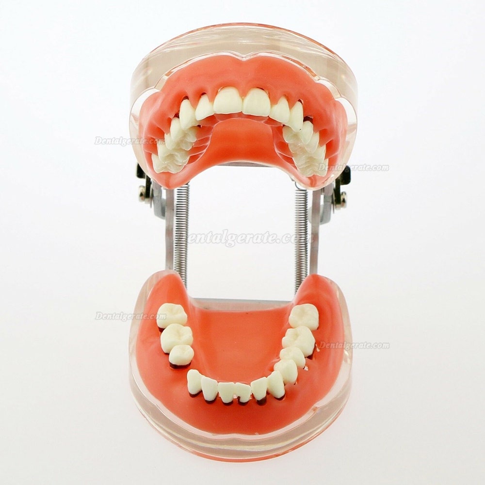 Dentalmodell Erwachsene Pathologische Parodontitis Studienzähne Modell 4017 Dentalmodell Erwachsene Pathologische Parodontitis Studienzähne Modell 4017