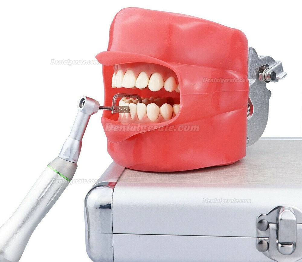 Westcode Dental Interproximaler Reduktion Instrumente IPR Kit + 4:1 Winkelstück Handstück Westcode Dental Interproximaler Reduktion Instrumente IPR Kit + 4:1 Winkelstück Handstück