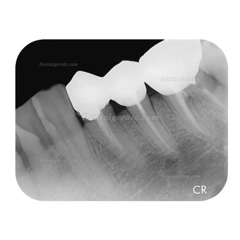 Apixia Dental Digitaler Phosphorplattenscanner (PSP-Scanner)