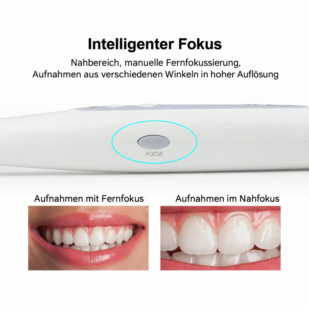 MLG CF686B dentale 4K-HD USB Intraoralkamera, 1/2,8-Zoll-Sensor
