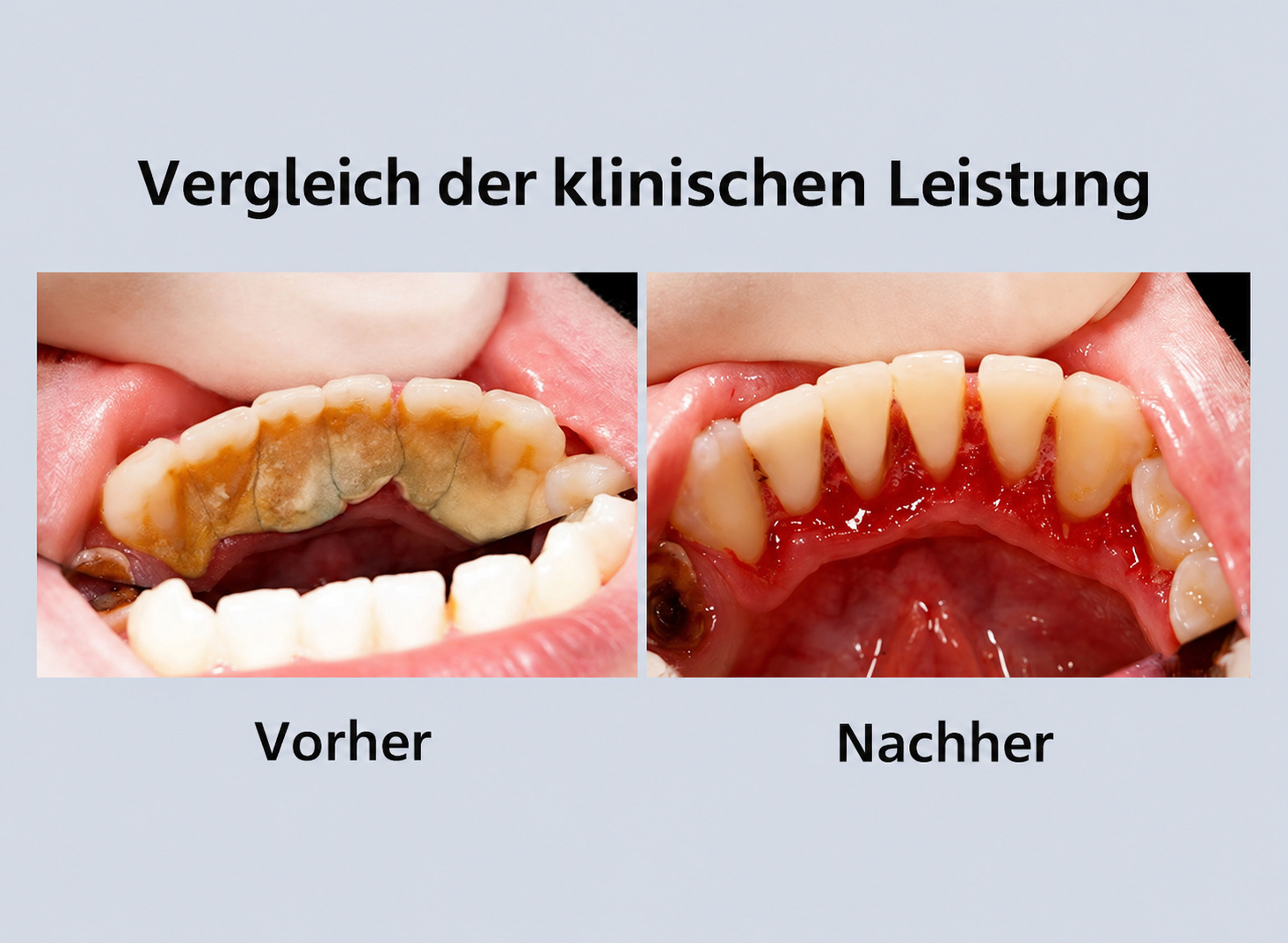 PlusPower Vanta digitales ultraschallScaler