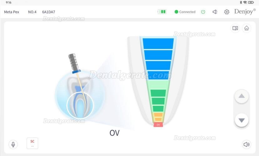 Denjoy MeteEndo Dental Endo Integriertes System (mit Meta Fill/Meta Pex/Meta Motor/Meta Pulp/Meta Pack) Denjoy MeteEndo Dental Endo Integriertes System (mit Meta Fill/Meta Pex/Meta Motor/Meta Pulp/Meta Pack)