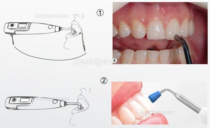 Denjoy MeteEndo Dental Endo Integriertes System (mit Meta Fill/Meta Pex/Meta Motor/Meta Pulp/Meta Pack) Denjoy MeteEndo Dental Endo Integriertes System (mit Meta Fill/Meta Pex/Meta Motor/Meta Pulp/Meta Pack)