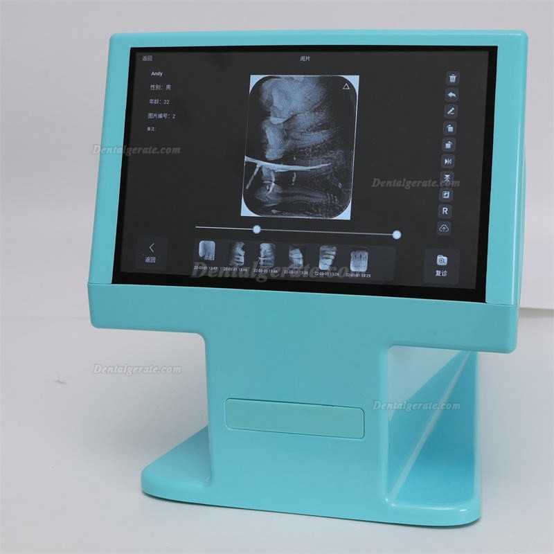 Dynamic DDT-100A digitaler r&ouml;ntgen-phosphorplattenscanner, speicherfolienscanner f&uuml;r Zahn&auml;rzte