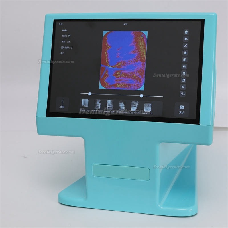 Dynamic DDT-100A digitaler r&ouml;ntgen-phosphorplattenscanner, speicherfolienscanner f&uuml;r Zahn&auml;rzte