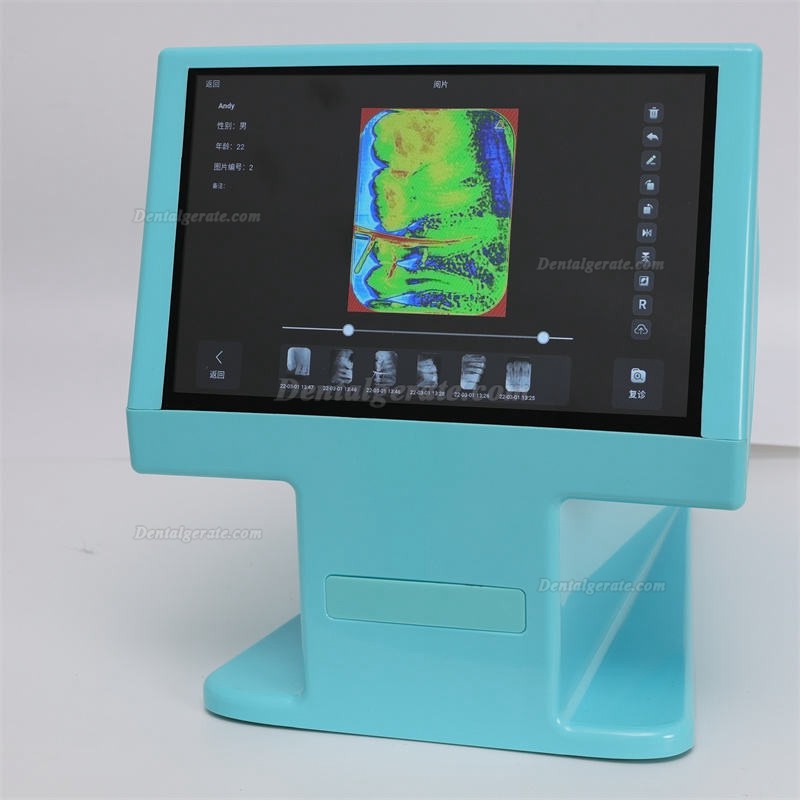 Dynamic DDT-100A digitaler r&ouml;ntgen-phosphorplattenscanner, speicherfolienscanner f&uuml;r Zahn&auml;rzte