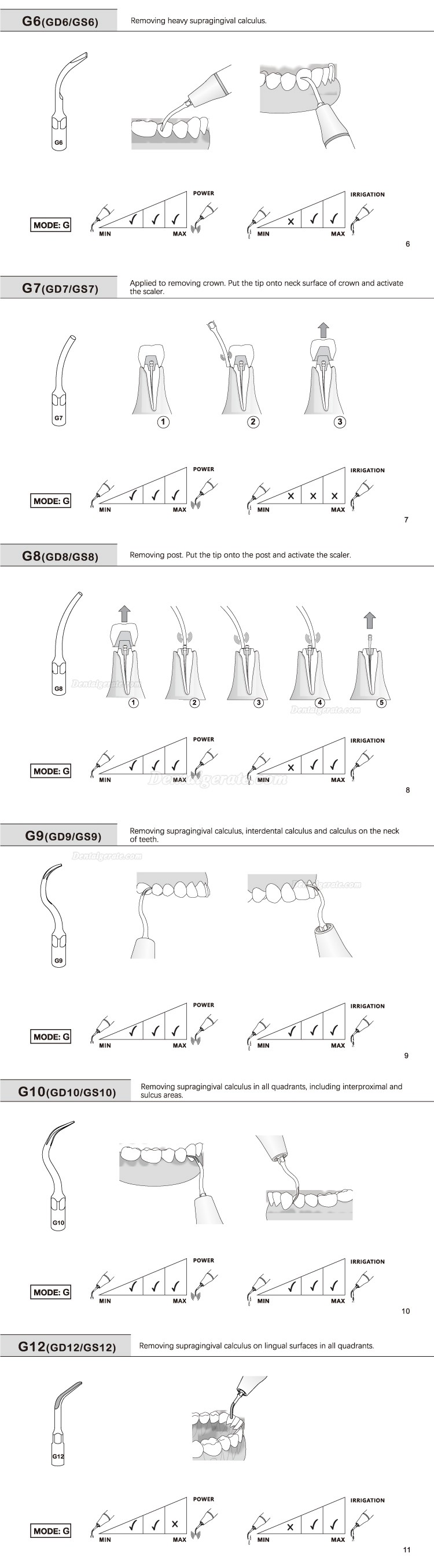 10 Stücke Refine® Ultraschall Piezo Spitzen für Prophylaxe G1 G2 G3 G4 G5 G6 GD1 GD2 GD3 GD4 GD5 GD6 (Kompatibel Mit Woodpecker EMS)