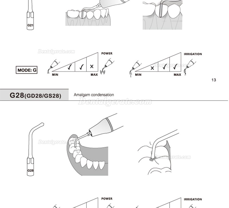 5 St&uuml;cke Refine&reg; Ultraschall Scaler Spitzen f&uuml;r Restauration G20 G21 G30 G31 G32 G33 G35 Kompatibel Mit Woodpecker EMS