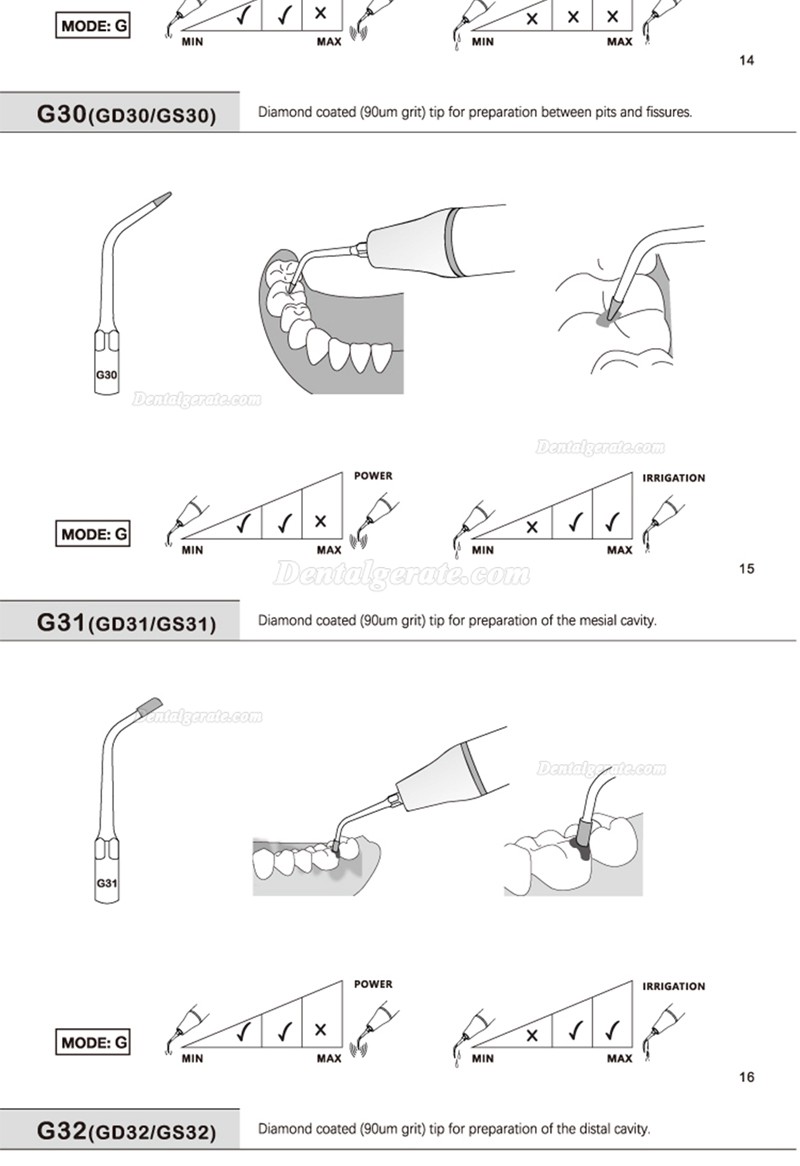5 St&uuml;cke Refine&reg; Ultraschall Scaler Spitzen f&uuml;r Restauration G20 G21 G30 G31 G32 G33 G35 Kompatibel Mit Woodpecker EMS