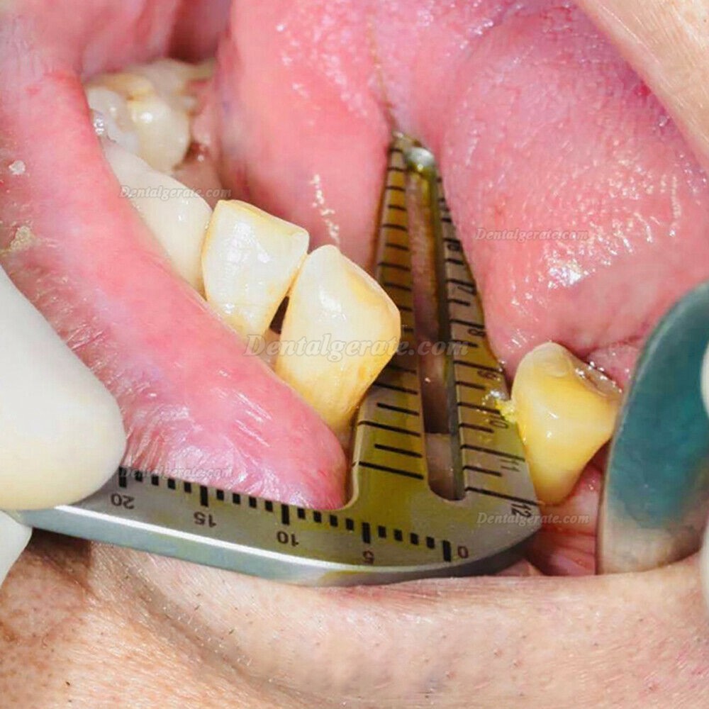 TT® Zahn Implantat FüHrung Set L&S Bohr Positionierungs Lineal Winkel Lineal Implantat Werkzeuge