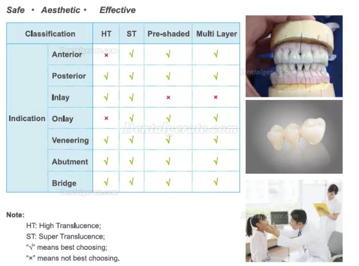 Kingch® ST-M 3D-M 98/95mm Dentallabor Vorgefärbt Zirkon Ronden CAD/CAM Keramik Blöcke Kingch® ST-M 3D-M 98/95mm Dentallabor Vorgefärbt Zirkon Ronden CAD/CAM Keramik Blöcke