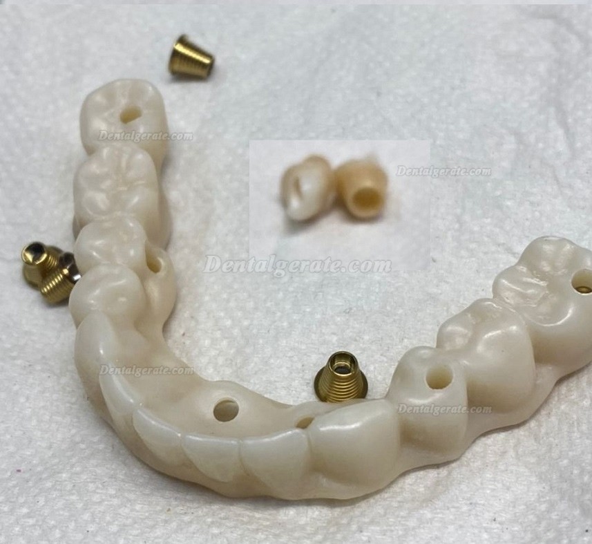 Kingch® ST-M 3D-M 98/95mm Dentallabor Vorgefärbt Zirkon Ronden CAD/CAM Keramik Blöcke Kingch® ST-M 3D-M 98/95mm Dentallabor Vorgefärbt Zirkon Ronden CAD/CAM Keramik Blöcke