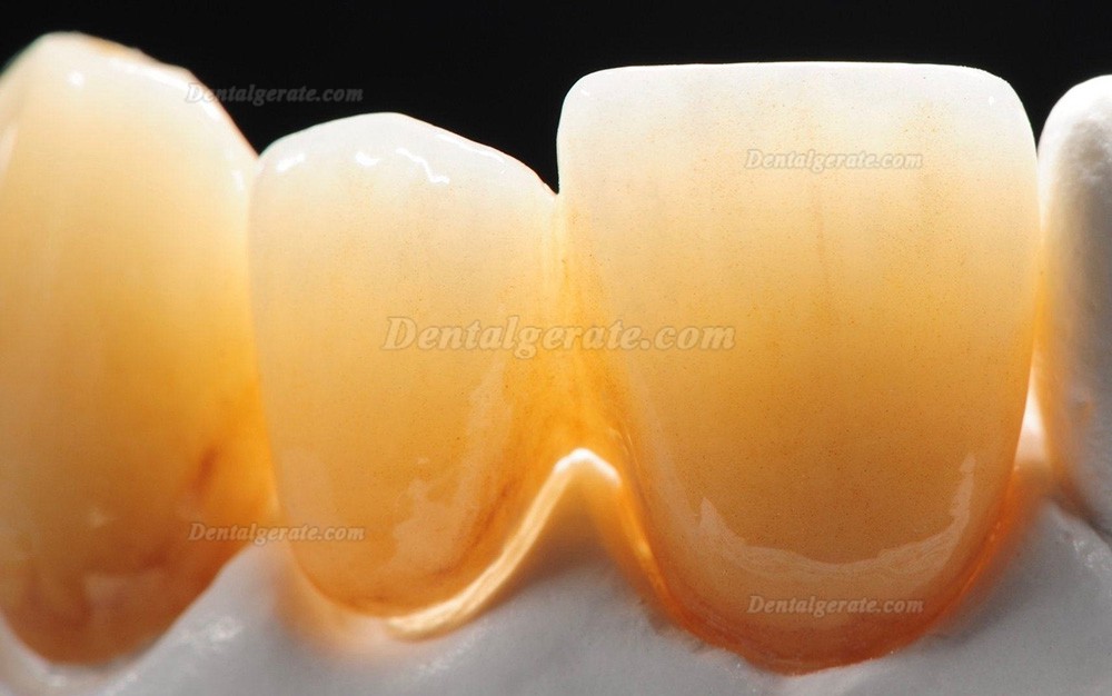 Kingch® ST-M 3D-M 98/95mm Dentallabor Vorgefärbt Zirkon Ronden CAD/CAM Keramik Blöcke Kingch® ST-M 3D-M 98/95mm Dentallabor Vorgefärbt Zirkon Ronden CAD/CAM Keramik Blöcke