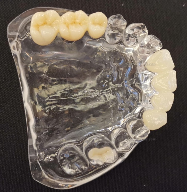 Kingch&reg; 3D-M 98/95mm Dentallabor Mehrschichtig Zirkon Ronden Zirkonoxid Bl&ouml;cke CAD/CAM Fr&auml;srohlinge