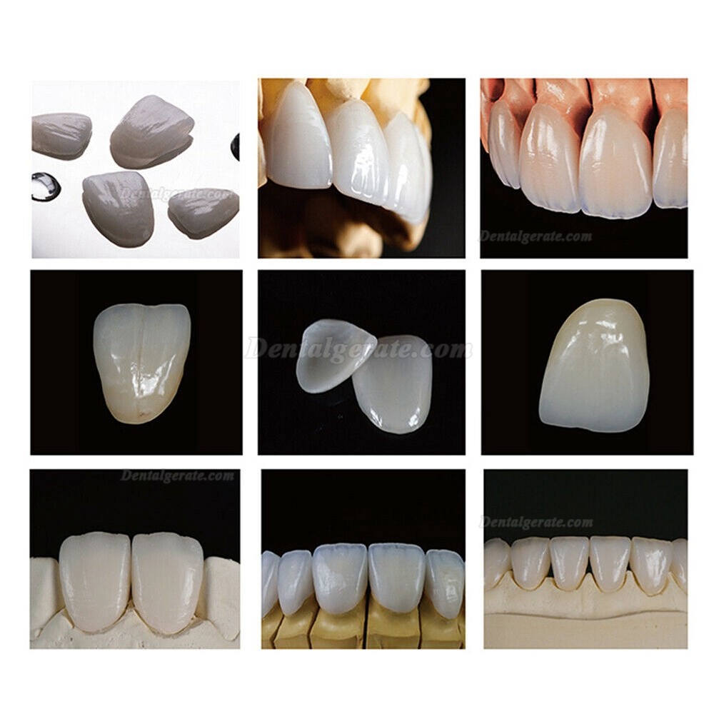 5 Stücke B40 HT/LT Lithiumdisilikat Glaskeramik Presskeramik Präfabrizierter Blöckchen (für Sirona Cerec CAD/CAM Fräsmaschine) 5 Stücke B40 HT/LT Lithiumdisilikat Glaskeramik Presskeramik Präfabrizierter Blöckchen (für Sirona Cerec CAD/CAM Fräsmaschine)