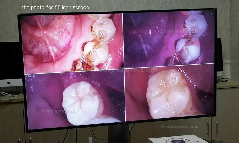 Magenta MD4000 Intraorale Kamera Kabellos Zahnarzt 1/4" CMOS VGA & HDMI Magenta MD4000 Intraorale Kamera Kabellos Zahnarzt 1/4" CMOS VGA & HDMI