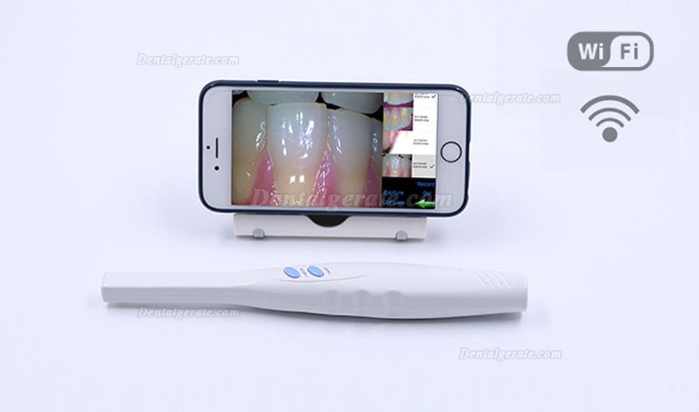 MLG CF-682 Wireless Intraoralkamera mit Wifi-Funktion für Zahnheilkunde MLG CF-682 Wireless Intraoralkamera mit Wifi-Funktion für Zahnheilkunde