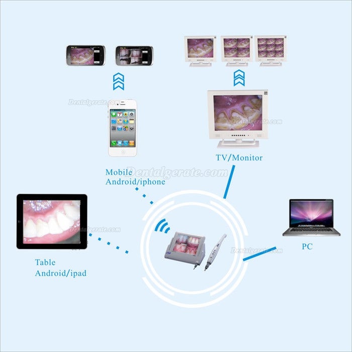 Dental Drahtgebundene WI-FI Intraoralkamera CF-988A mit 8-Zoll-LCD-Minotor M-868