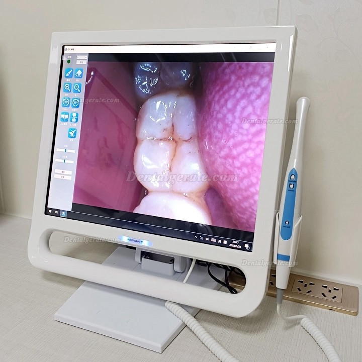 Magenta YF-1700P+ Dental 17 Zoll Touchscreen Intraorale Kamera