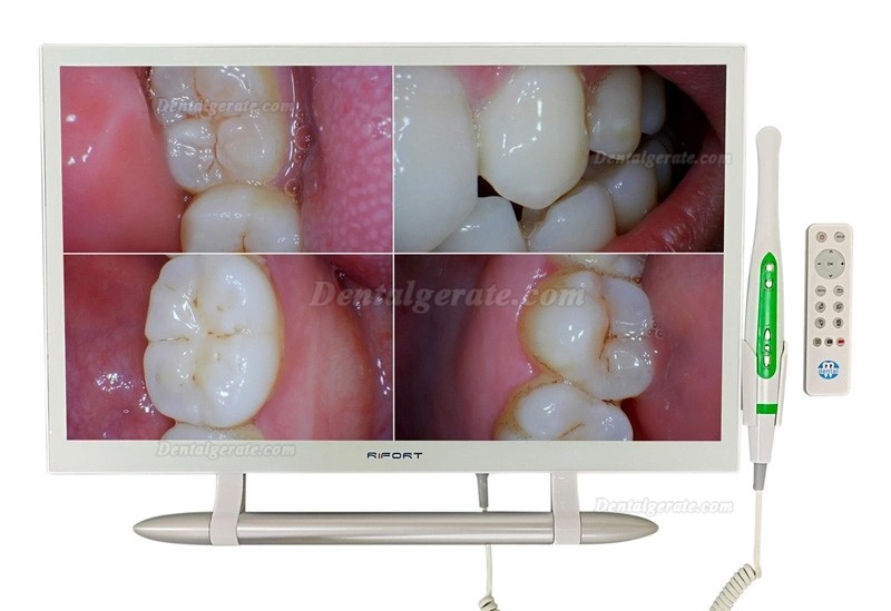 Magenta YF-2200M Dental-Intraoralkamera mit 21,5 Zoll Monitor und WIFI-&Uuml;bertragungs