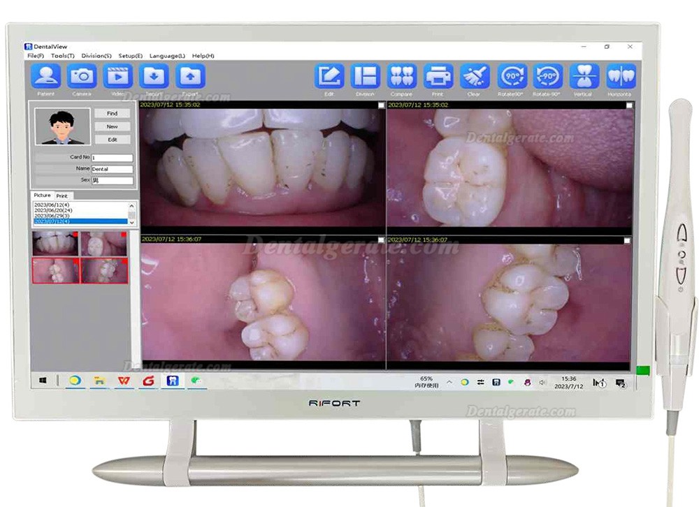 Magenta YF-2200P+ Dental Intraoralkamera VGA+HDMI mit 21,5 Zoll Touchscreen