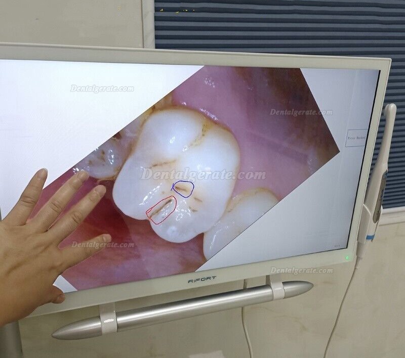 Magenta YF-2200P+ Dental Intraoralkamera VGA+HDMI mit 21,5 Zoll Touchscreen