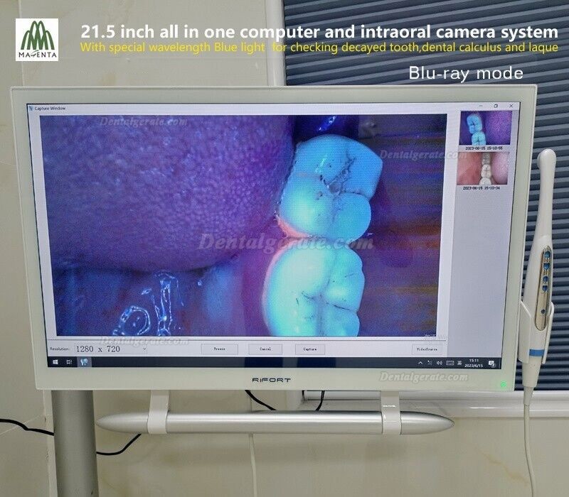 Magenta YF-2200P+ Dental Intraoralkamera VGA+HDMI mit 21,5 Zoll Touchscreen