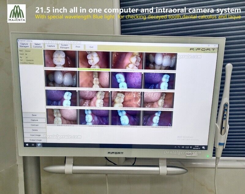Magenta YF-2200P+ Dental Intraoralkamera VGA+HDMI mit 21,5 Zoll Touchscreen