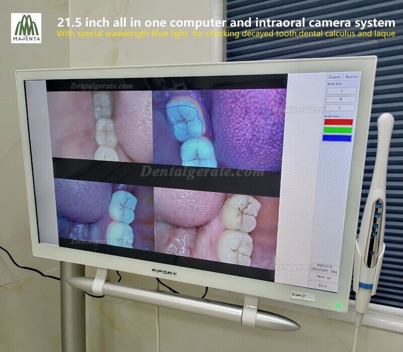 Magenta YF-2200P+ Dental Intraoralkamera VGA+HDMI mit 21,5 Zoll Touchscreen