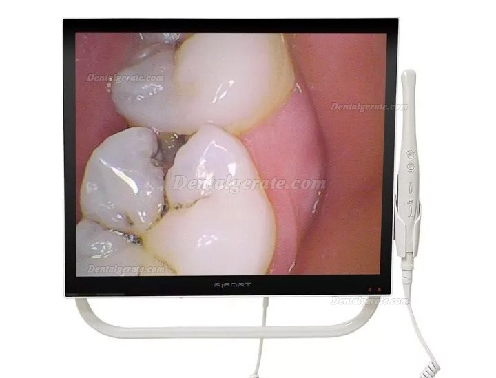 Magenta YFHD-D Dental Intraoralkamera 1/4 Sony CCD mit 17 Zoll Monitor und Halterung