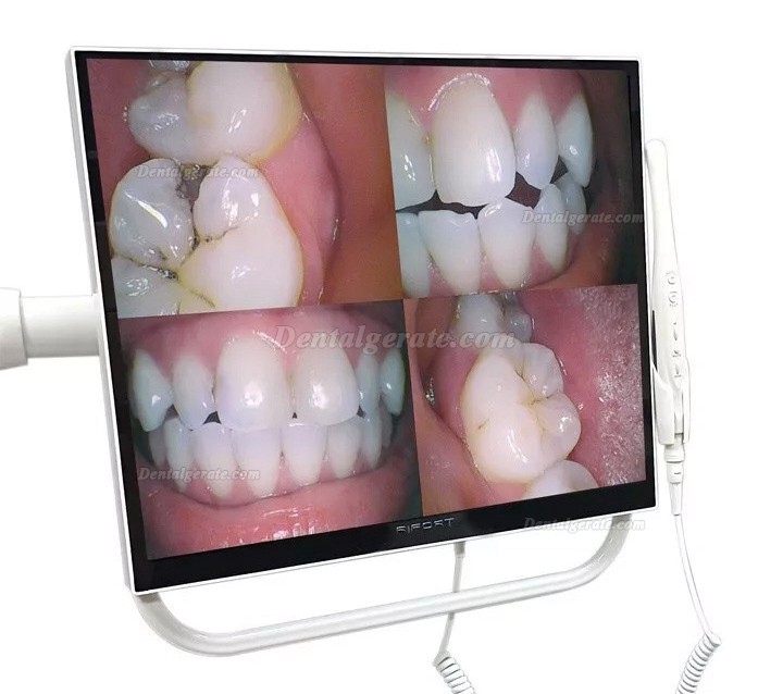 Magenta YFHD-D Dental Intraoralkamera 1/4 Sony CCD mit 17 Zoll Monitor und Halterung
