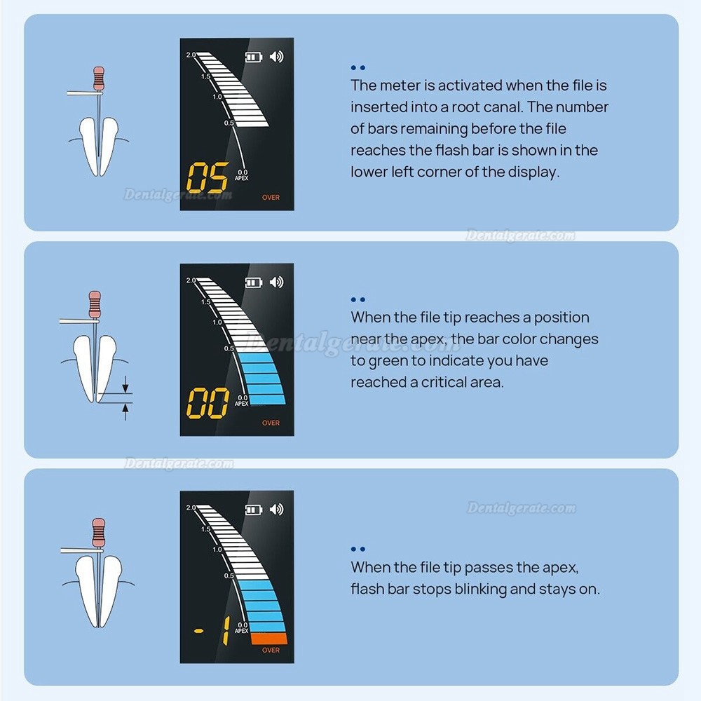 Dental Apex Locator Wurzelkanalmessger&auml;t Endodontie-Finder Micropex Pro