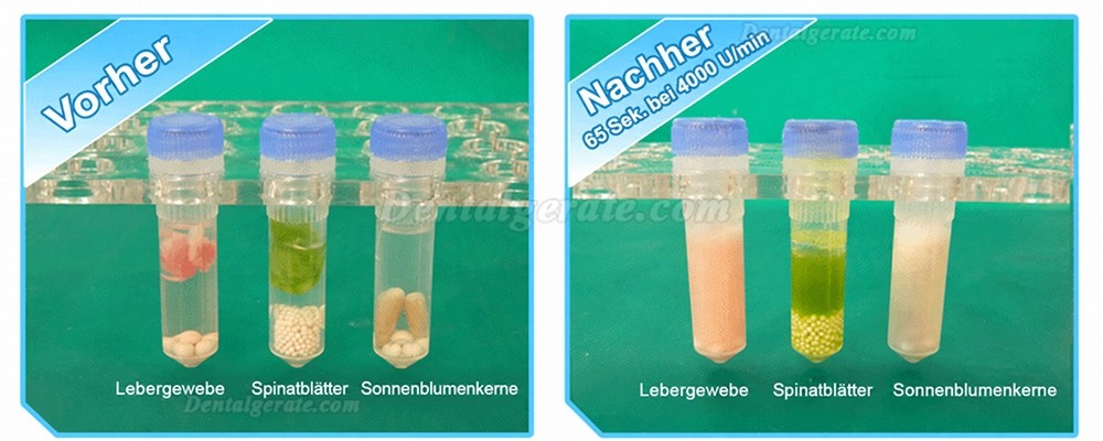 Zoneray Beadbug Mikror&ouml;hrchen-Homogenisator f&uuml;r Lab